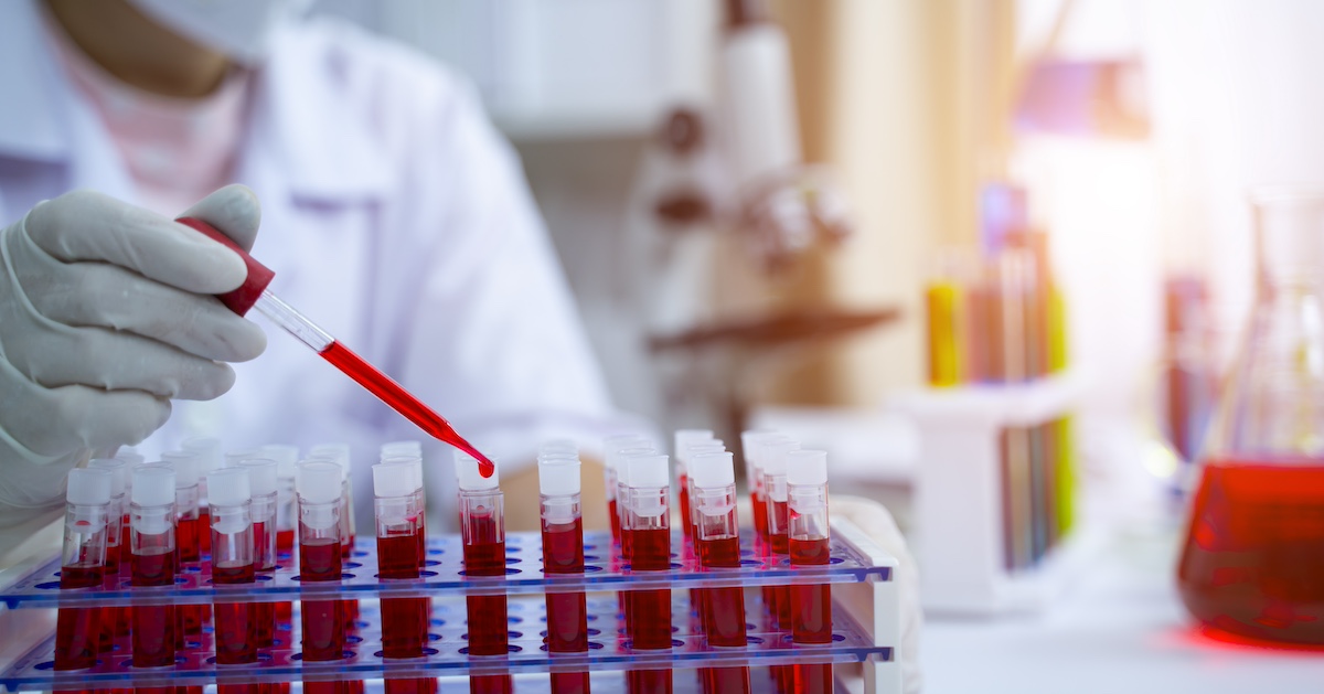 Scientist with test tubes filled with blood