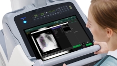 Fujifilm's FDR Go PLUS mobile x-ray