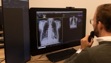 A radiologist reviewing an AI-generated chest X-ray analysis A radiologist reviewing an AI-generated chest X-ray analysis