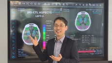 JLK CEO Dong-Min Kim showcasing their stroke AI solution JLK CEO Dong-Min Kim showcasing their stroke AI solution