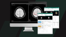 Neurophet's AI-powered Alzheimer's disease image analysis software
