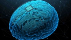 AI generated image of a brain implant on a brain AI generated image of a brain implant on a brain