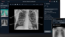 Mobile and desktop versions of Qure.ai's chest X-ray analysis solution Mobile and desktop versions of Qure.ai's chest X-ray analysis solution