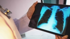 Doctor checking a chest X-ray film on a tablet Doctor checking a chest X-ray film on a tablet