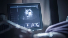 Sonogram monitor with person's hand Sonogram monitor with person's hand