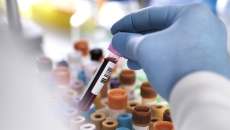 A close up of a lab worker holding a tube of blood A close up of a lab worker holding a tube of blood