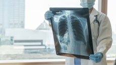 Germany’s Bayer has launched Saudi Arabia’s first “digital hub” to improve management of pulmonary hypertension (PH), it has announced. Bayer, Saudi, pulmonary hypertension