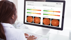 Also, PocDoc to launch smartphone-based blood test for cardiovascular disease. AXA Health, Thirona, Sectra, AI, Peppy