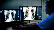 A radiologist analysing a chest X-ray using VinBrain DrAid A radiologist analysing a chest X-ray using VinBrain DrAid