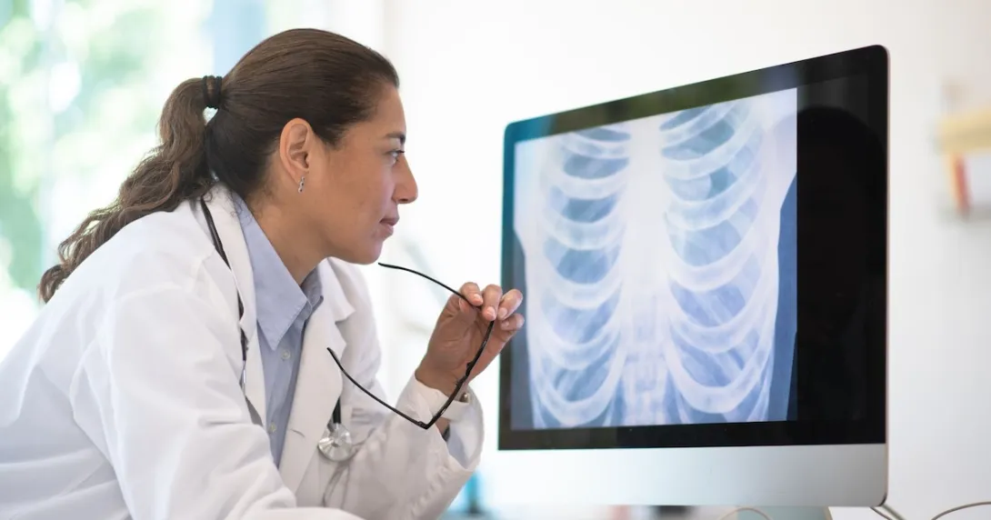A doctor reviewing a chest X-ray  A doctor reviewing a chest X-ray