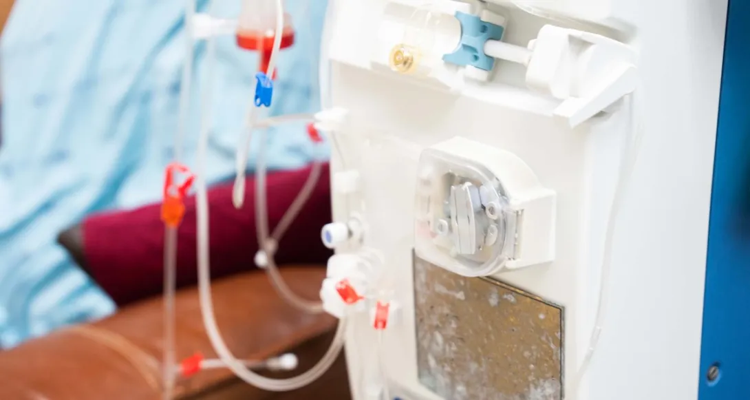 Dialysis machine Dialysis machine