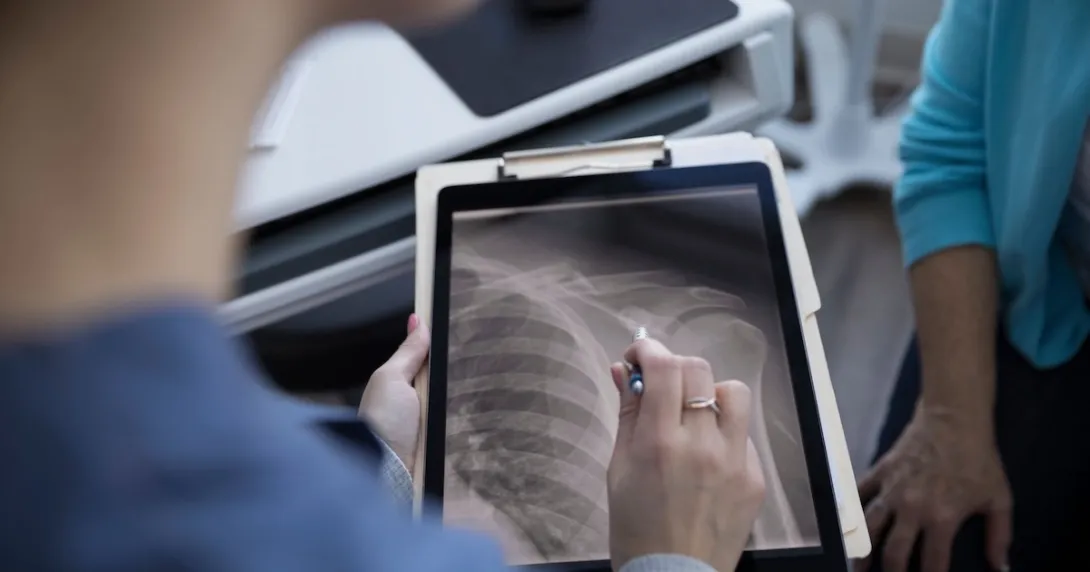 A doctor explaining findings from an X-ray image