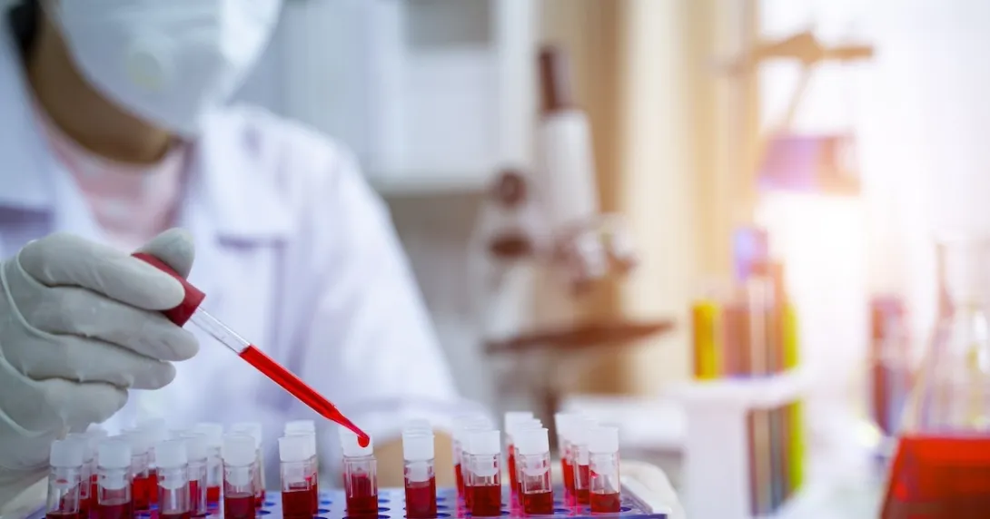 Lab technician at work Lab technician at work