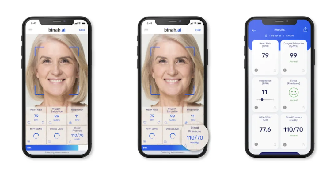 remote monitoring remote monitoring