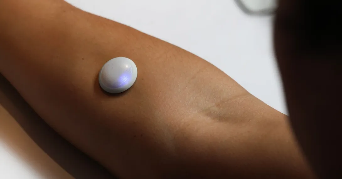 Biolinq glucose sensor Biolinq glucose sensor