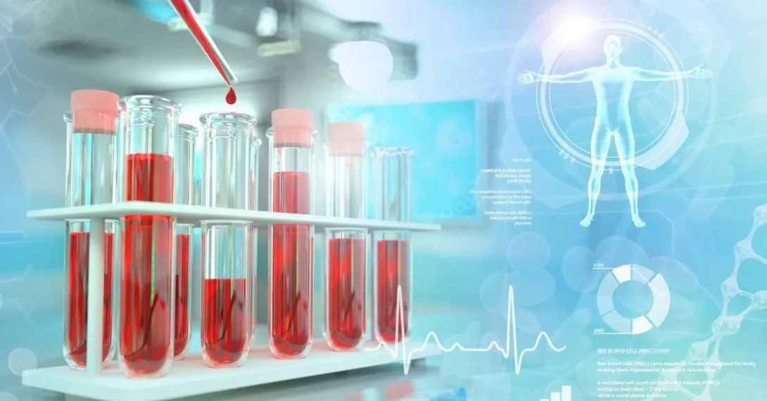 Blood test lab illustration