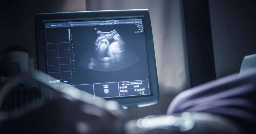 Sonogram monitor with person's hand Sonogram monitor with person's hand