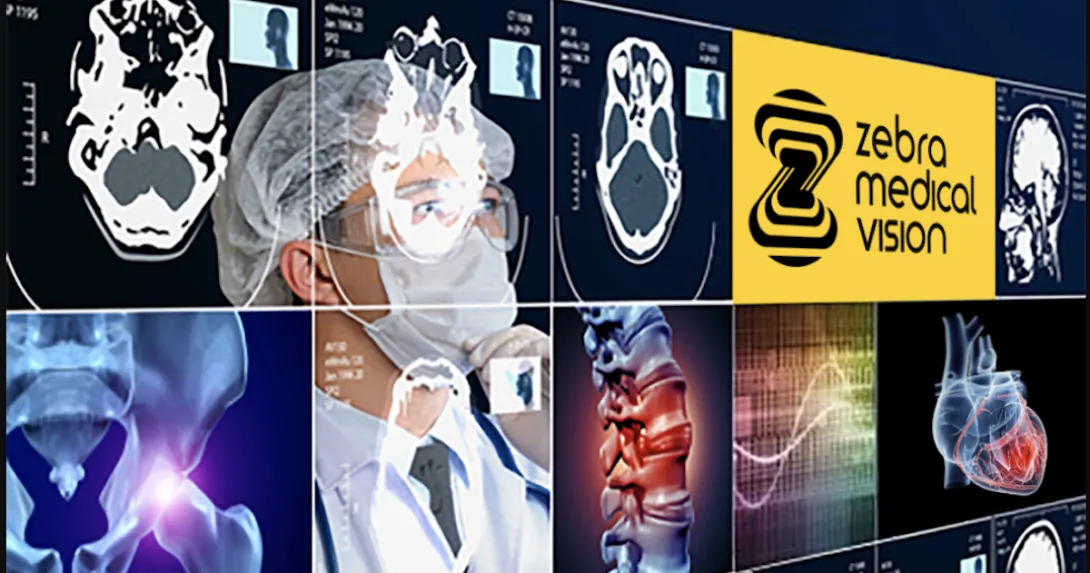 Zebra Medical Vision