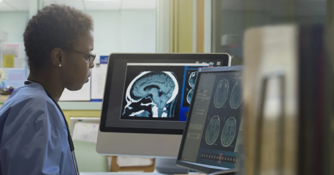 A radiologist looking at brain imaging results in a hospital. A radiologist looking at brain imaging results in a hospital.