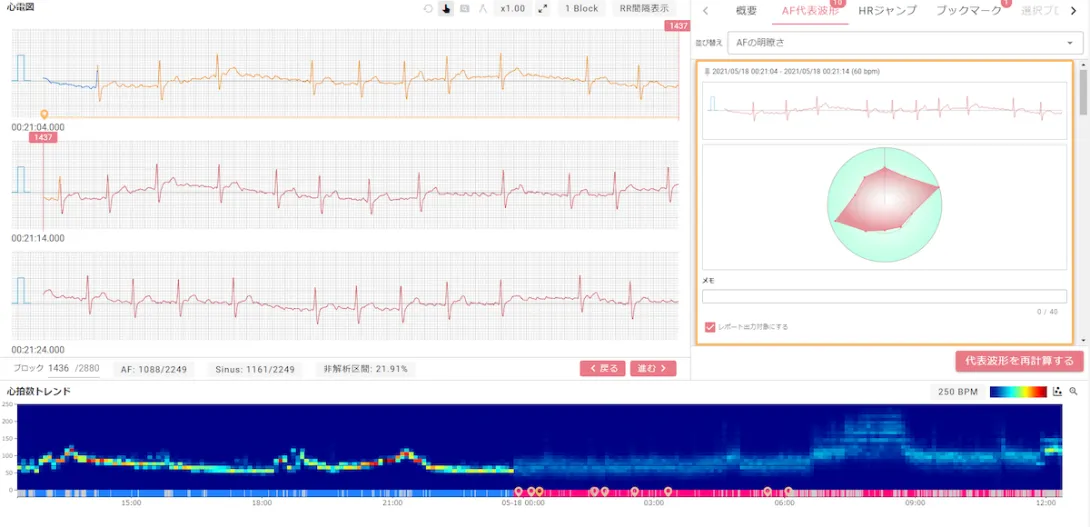 SmartRobin AI interface SmartRobin AI interface