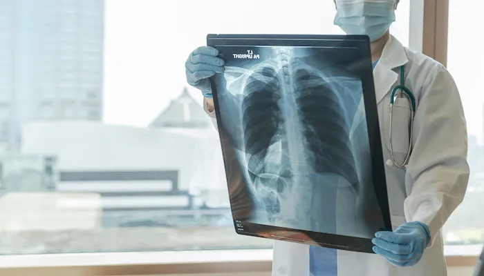 Germany’s Bayer has launched Saudi Arabia’s first “digital hub” to improve management of pulmonary hypertension (PH), it has announced. Bayer, Saudi, pulmonary hypertension