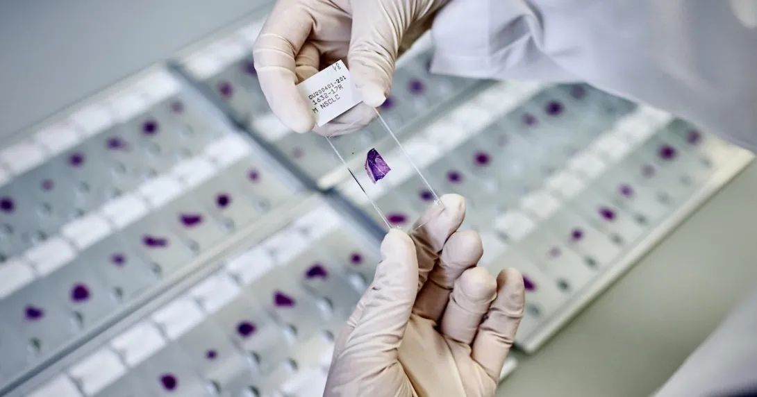 A stained slide being prepared for AI-powered analysis A stained slide being prepared for AI-powered analysis